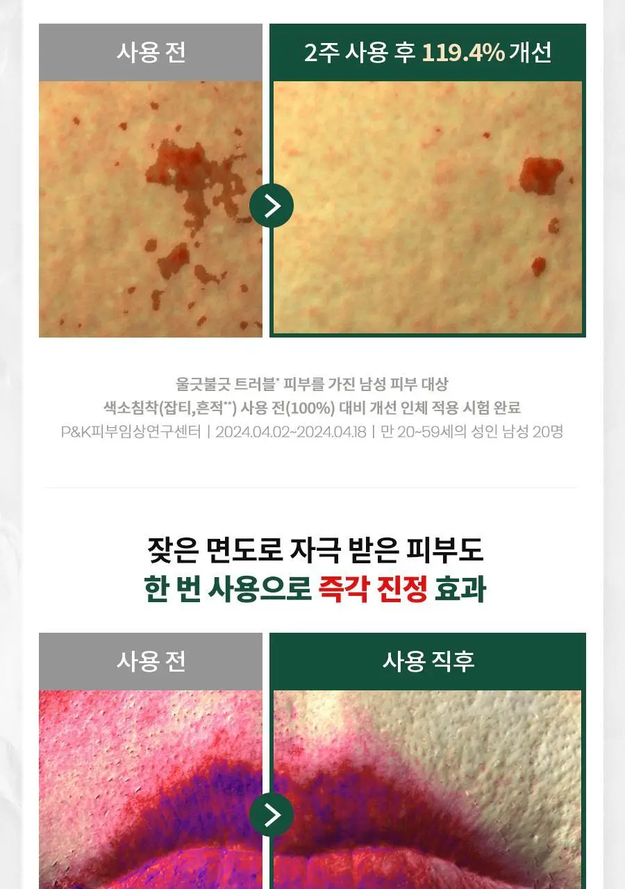 [선케어/반톤업] 닥터지 레드 블레미쉬 포 맨 올인원 톤 로션 50ml 기획 (+젠틀폼 30ml) 상세페이지 33